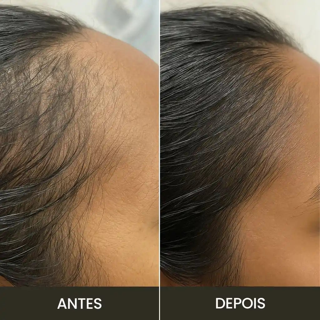 Escova Anti-Queda Therabrush