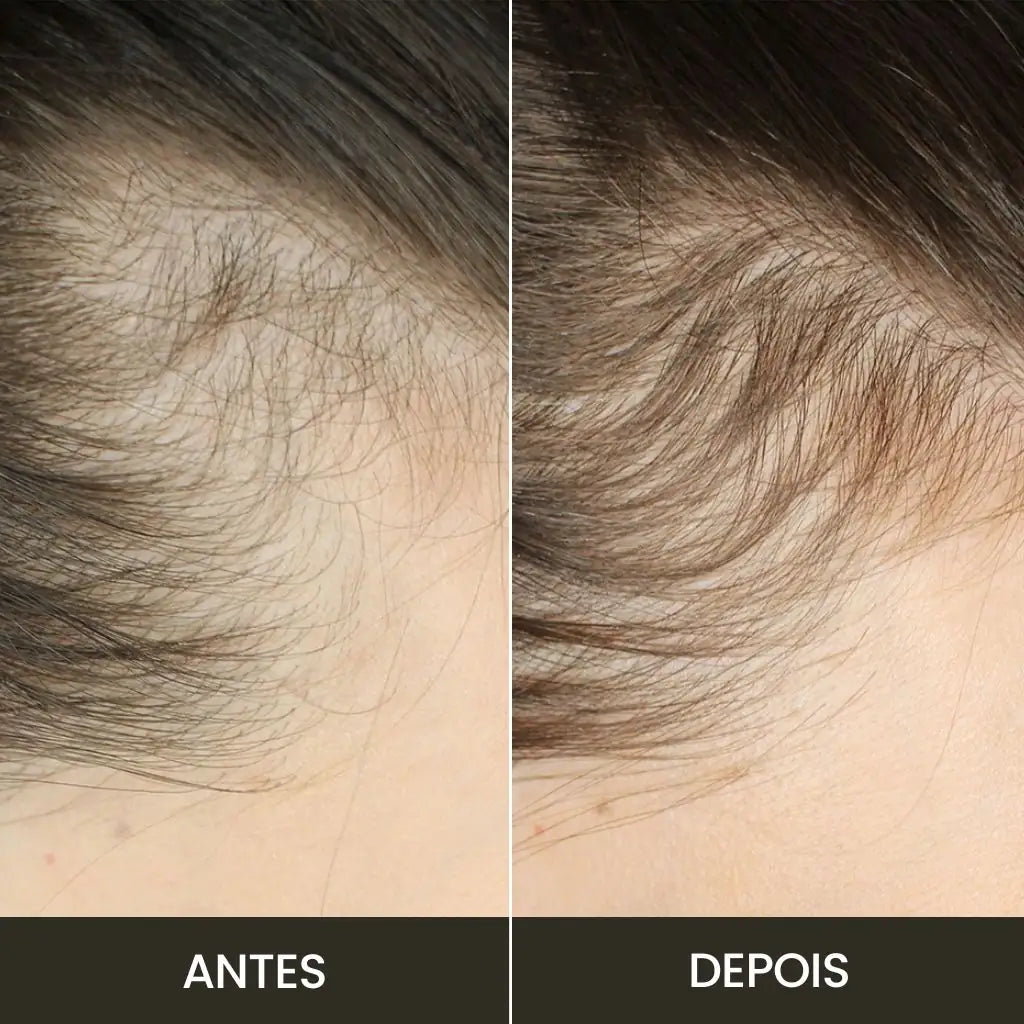 Escova Anti-Queda Therabrush